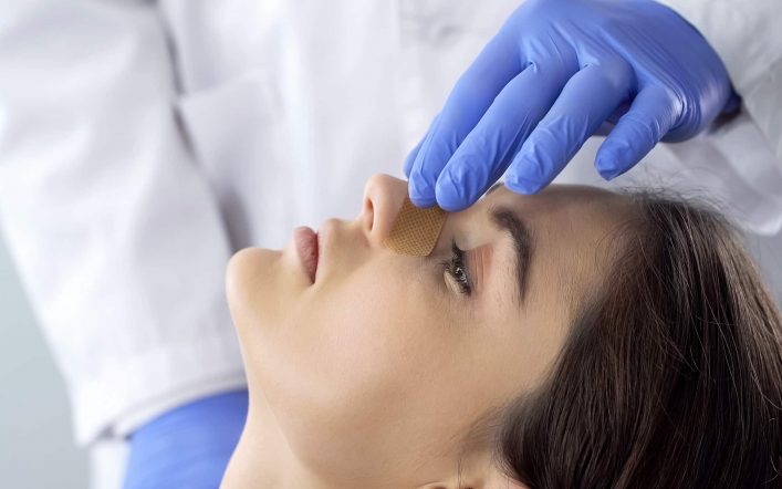 Tips for Choosing a Rhinoplasty Surgeon for Your Nose Job